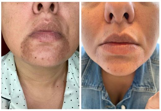 Resultado de MARTHA PEREZ