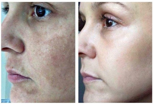 Resultado de Luciana